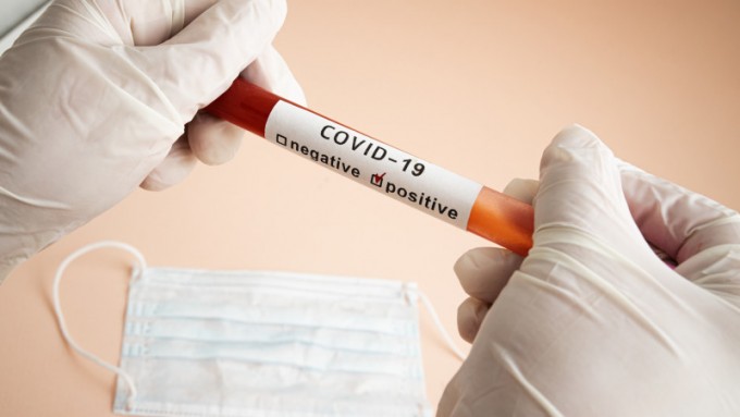 Nyu-York hayvonot bog‘idagi yo‘lbars koronavirus yuqtirib oldi